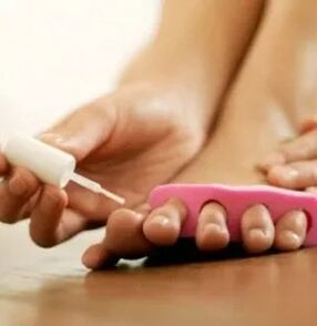 Toepassing van therapeutische vernis